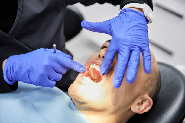Best Broken Tooth Emergency  in Mabton, WA
